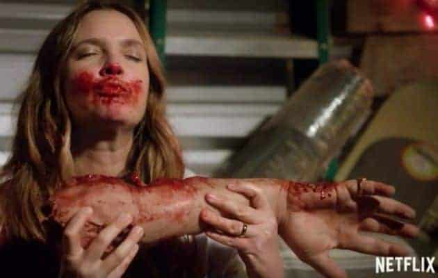 On vous a dit que le bras était très tendre?