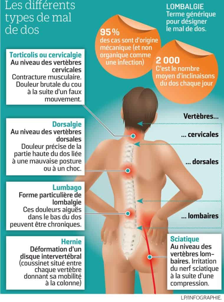 Les différents types de mal de dos